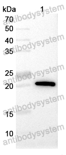 Mouse Anti-Monkeypox virus/MPXV M1R Antibody (SAA0283)